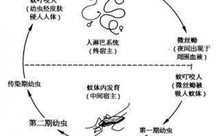 丝虫病，丝虫病症状表现